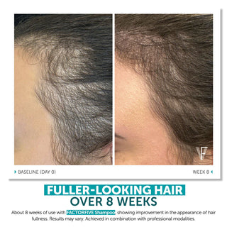 Factor Five Advanced Haircare Shampoo