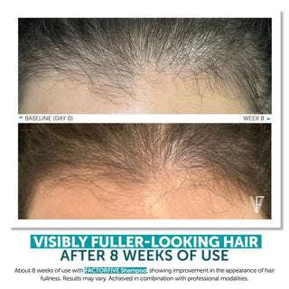 Factor Five Advanced Haircare Shampoo